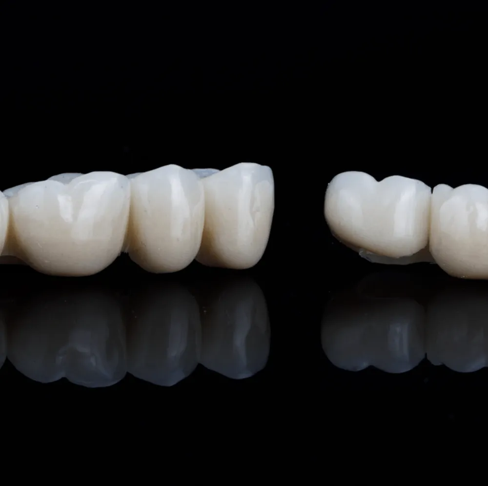 Ceramic dental crowns