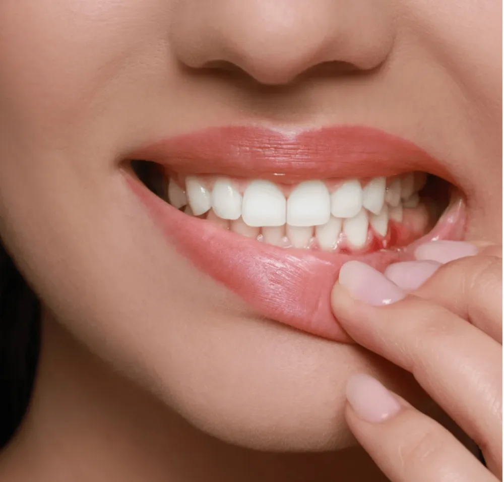 Healthy gums after gum disease treatment