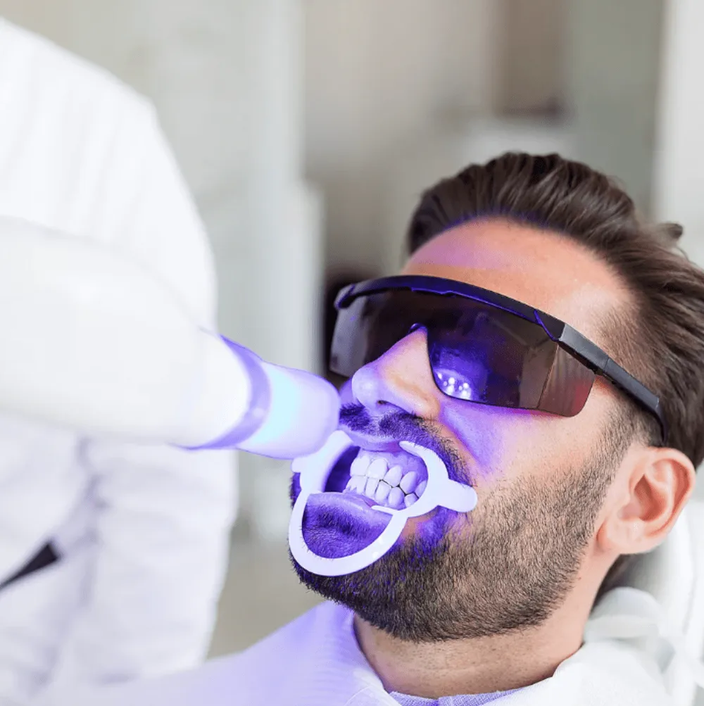 Smile after professional teeth whitening