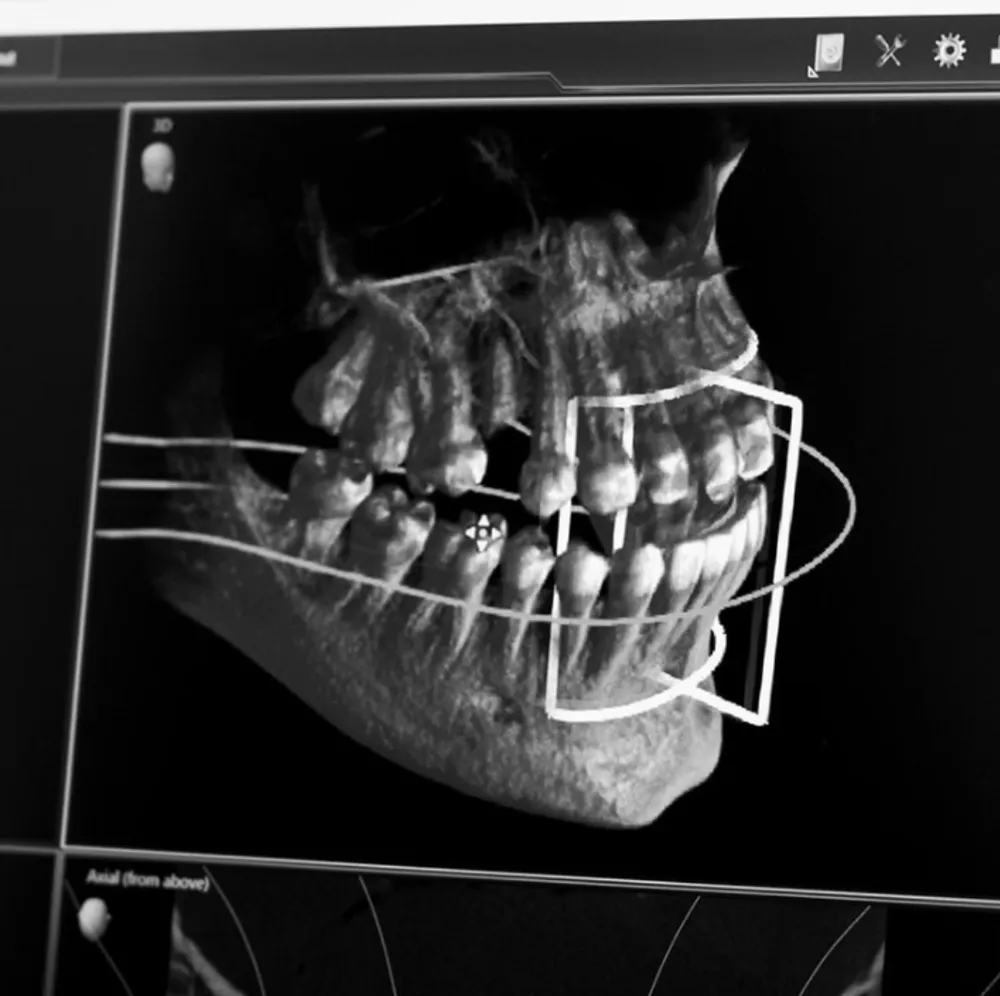 Digital smile design planning on screen